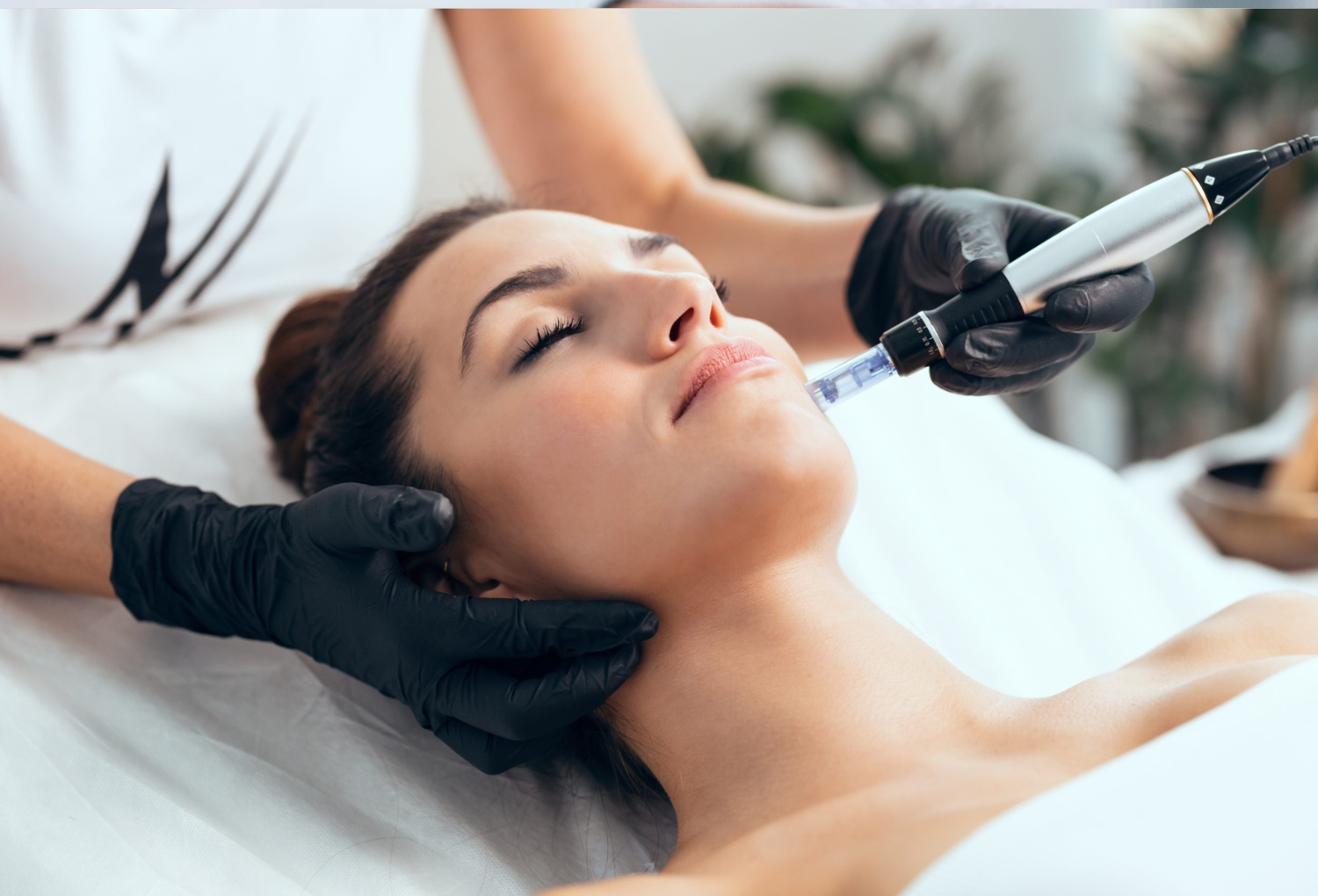 Woman receiving microneedling treatment with PRP, performed by a professional in a medical spa setting, emphasizing aesthetic and wellness services.