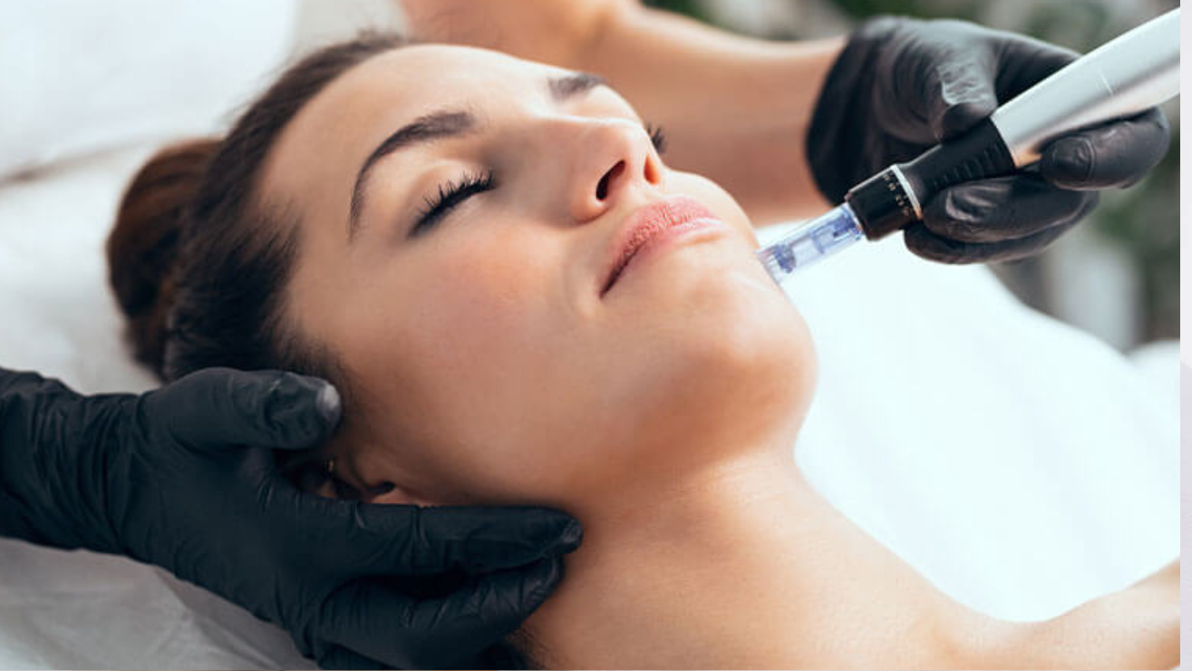 Woman receiving microneedling treatment for skin rejuvenation, with an aesthetician using a microneedling device, highlighting advanced skincare techniques at Skin and Body Bar in Frankfort.